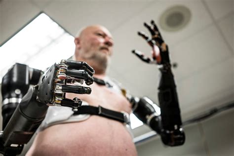 These robotic limbs are a curse